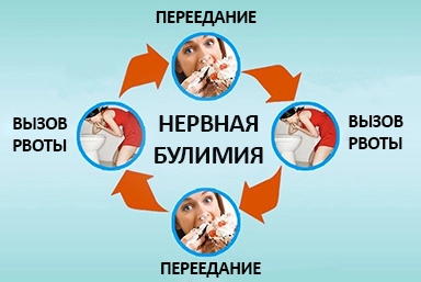 Лечение булимии в Романово